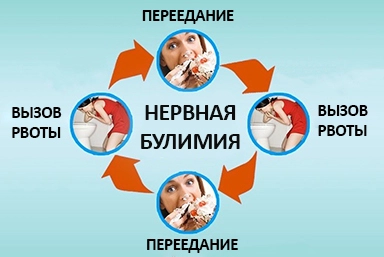 Лечение булимии в Надыме